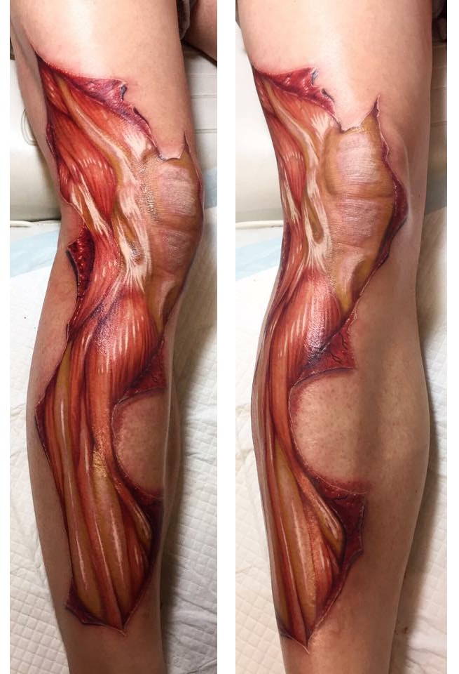 Skinned Leg